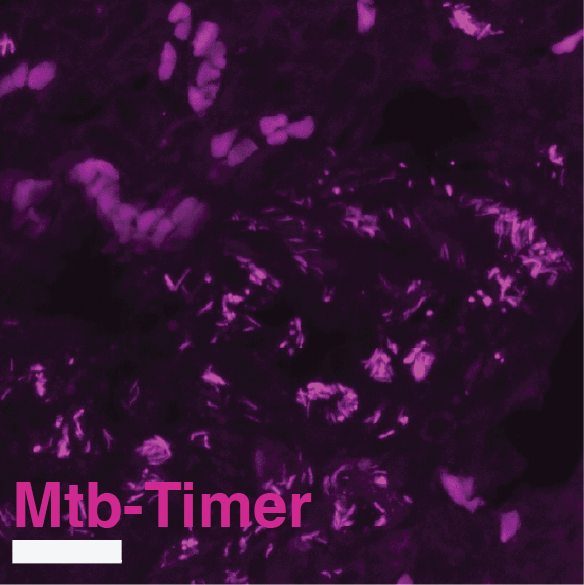 Supplementary Figure S8F Mtb-Timer Magenta